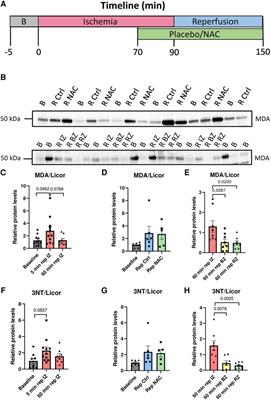 Myocardial oxidative stress is increased in early reperfusion, but systemic antioxidative therapy does not prevent ischemia-reperfusion arrhythmias in pigs